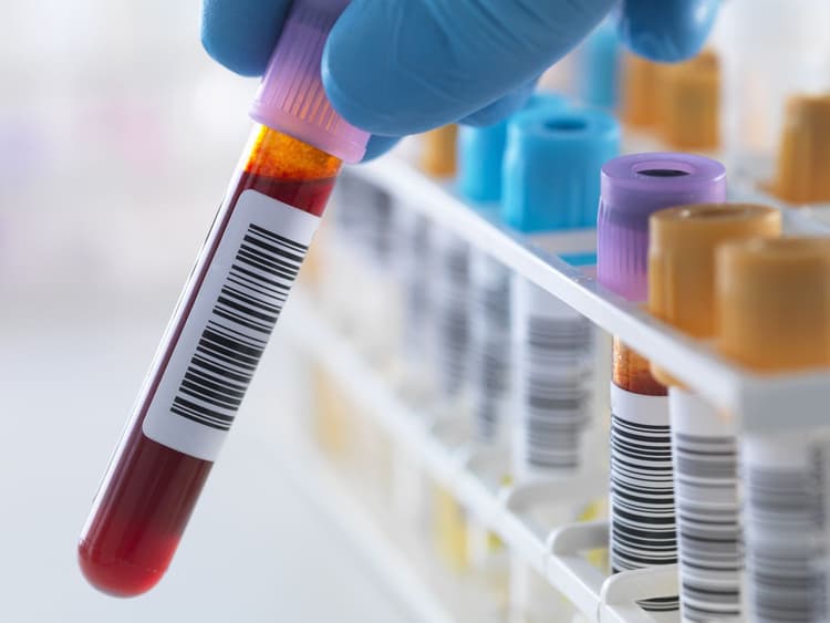 Lab Test Now At-Home Lab Testing Services | Mobile Medical Lab